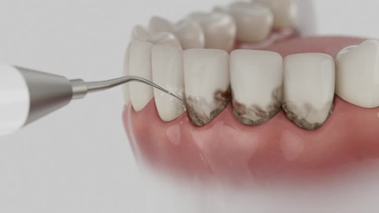 Trusted Wisdom Tooth Removal service in Tama, IA - Dentist Open Now